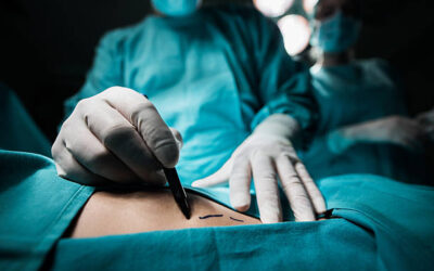 Chirurgie esthétique en Tunisie : qualité médicale et tarifs avantageux