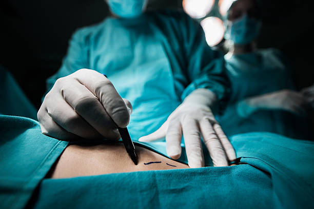 chirurgie esthétique